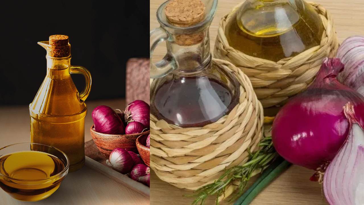 Onion Oil : ఉల్లిపాయ నూనె వలన కూడా అనేక ఉపయోగాలు ఉంటాయని తెలుసా?